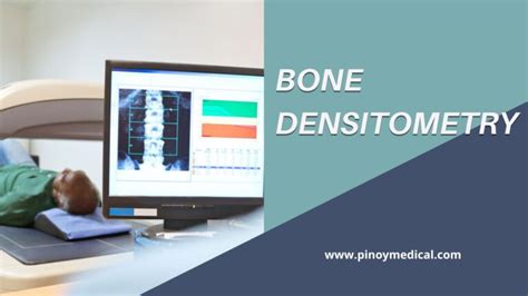 Bone Density Test in Philippines .